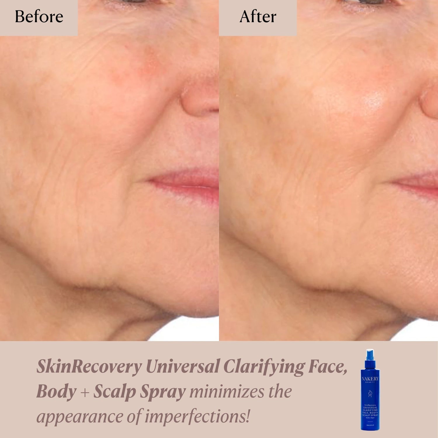 Nakery Beauty SkinRecovery Clarifying Face, Body + Scalp Spray